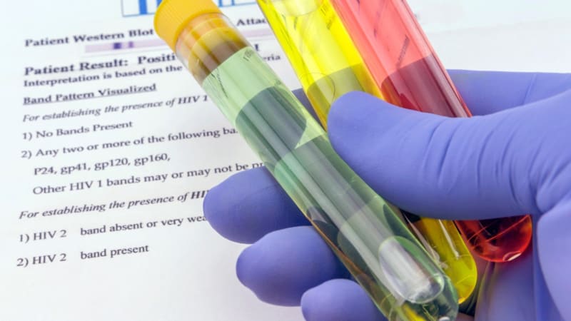 Tropický ráj drtí epidemie HIV. Fidži vyhlásilo stav nouze, problémem je i „hotspotting“